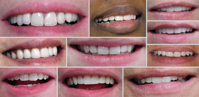 avignon dentiste